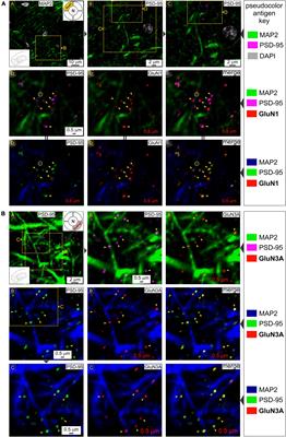 Visualizing the triheteromeric N-methyl-D-aspartate receptor subunit composition